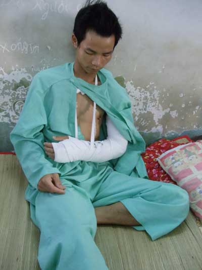 Nạn nhân Bùi Như Đào đang điều trị tại BV Chấn thương Chỉnh hình TP.HCM