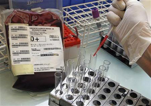 Thử máu có thể xác định hiệu quả điều trị ung thư