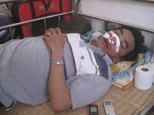 Kiểm lâm viên Phạm Ngọc Phương bị lâm tặc tấn công bị thương ở mặt đang điều trị tại bệnh viện