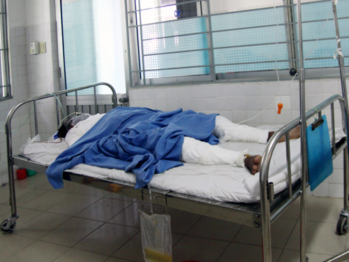 Nạn nhân bị bỏng rất nguy kịch được chữa trị tại BV Đà Nẵng