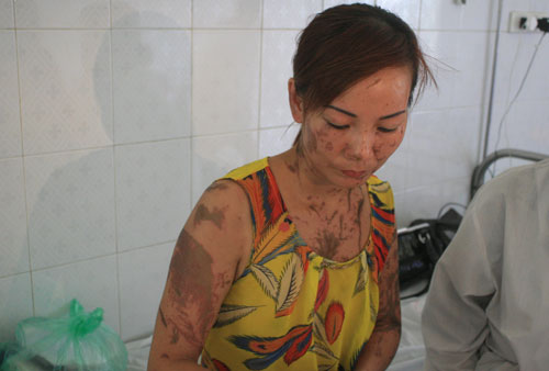 Vụ tạt axit cả gia đình 5 người ở Nam Định: Hung thủ dự mưu từ trước đó hơn nửa tháng 2