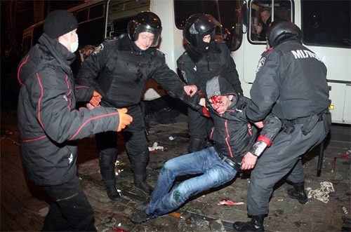 Một người bị thương trong vụ xô xát ở Donetsk - Ảnh: AFP