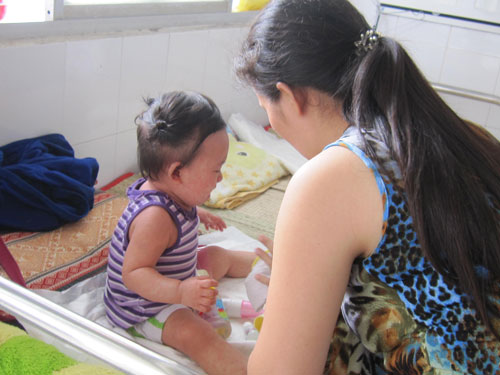 Trẻ đang điều trị sởi tại khoa Nhiễm, BV Nhi đồng 1 ngày 18.4 1