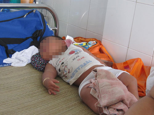 Trẻ đang điều trị sởi tại khoa Nhiễm, Bệnh viện Nhi đồng 1 ngày 18.4