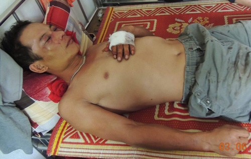 Anh Nguyễn Tuấn Thúc bị nhóm côn đồ chém trọng thương, hiện đang nằm điều trị tại Bệnh viện Đa khoa huyện Đức Thọ - Ảnh: Dũng Thức