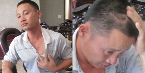 Vụ chém người dã man ở Hà Tĩnh: Có dấu hiệu người cha nhận tội thay cho con 