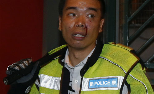 Một cảnh sát bị thương khi đụng độ với người biểu tình - Ảnh: Reuters