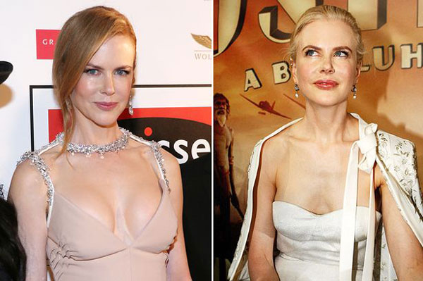 Nicole Kidman lộ vòng 1 to bất thường 1