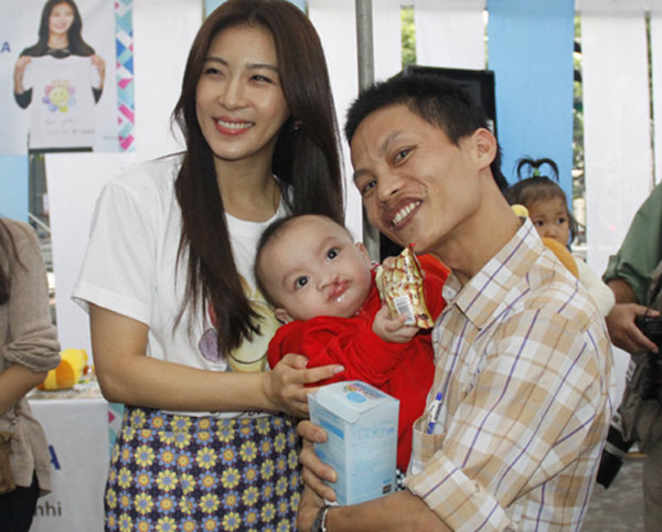 Ha Ji Won tận tay trao hơn 700 phần quà cho trẻ em dị tật hở hàm ếch 10