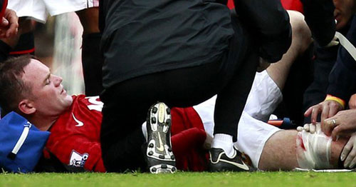 Rooney nghỉ 4 tuần - Rooney bị vết cắt khá sâu ở đùi phải 