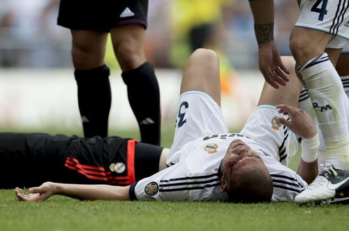 Pepe vắng mặt trong trận siêu cúp Tây Ban Nha