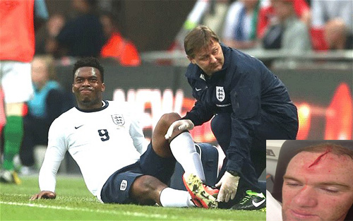 Tiền đạo Rooney và Sturridge bị chấn thương nặng đều phải chia tay tuyển Anh - d