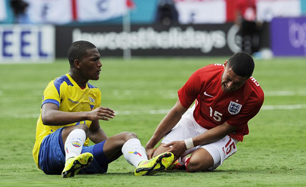 Chamberlain (phải) gặp xui xẻo khi World Cup còn gần 1 tuần nữa là khai mạc