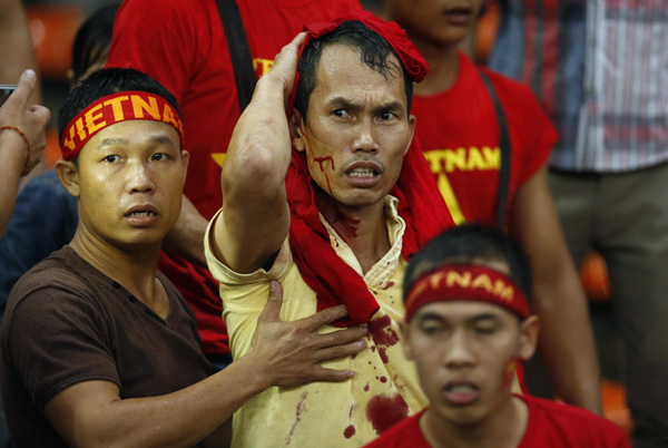 Cổ động viên VN chảy máu đầu trên sân Shah Alam do bị vài kẻ quá khích của Malaysia tấn công - Ảnh: Reuters
