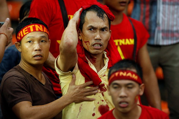 Một fan người Việt Nam đổ máu sau khi một nhóm hooligan Malaysia lao vào hành hung vào cuối trận - Ảnh: Reuters
