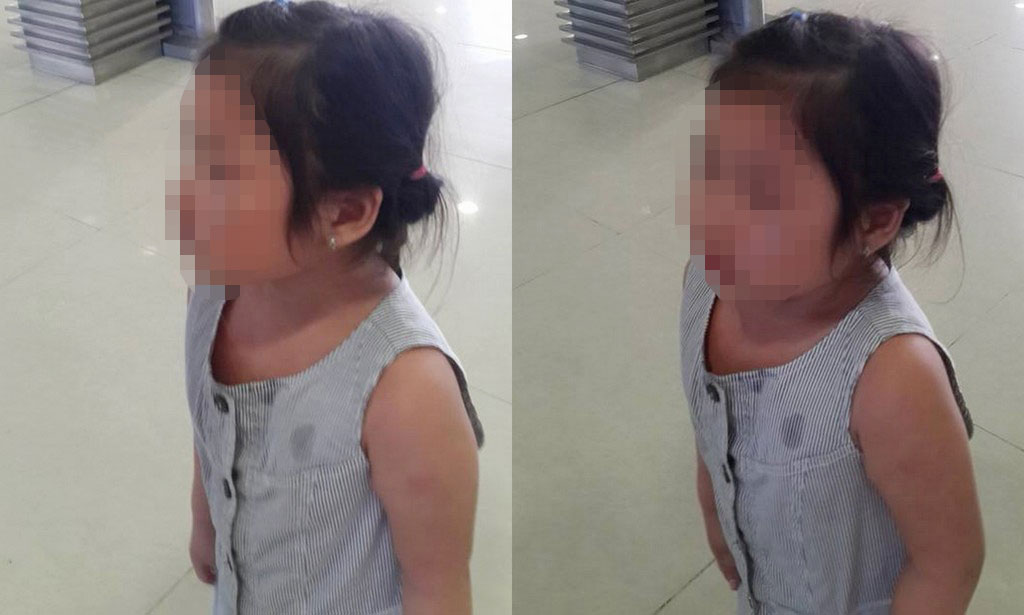 Vụ bé gái bị đánh sưng tím mặt mày gây phẫn nộ trong cộng đồng mạng - Ảnh: Nhân chứng cung cấp