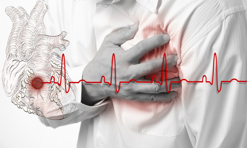 Giận dữ liên tục khiến huyết áp tăng, dễ dẫn đến đau tim - Ảnh: Shutterstock