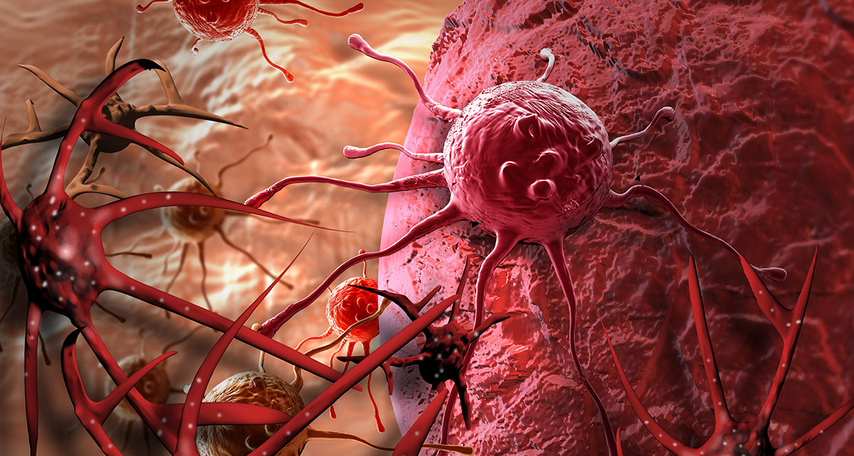 Tế bào ung thư sinh sản và phát triển một cách chóng mặt - Ảnh: Shutterstock