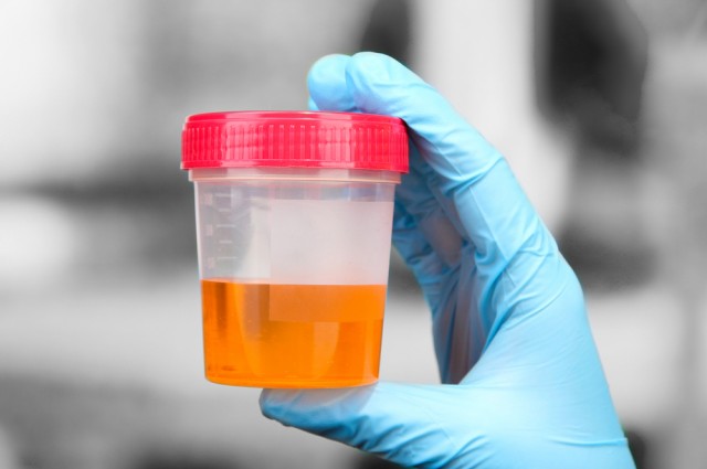 Không chỉ là chất thải, nước tiểu còn là dấu hiệu cảnh báo những vấn đề của sức khỏe - Ảnh: Shutterstock