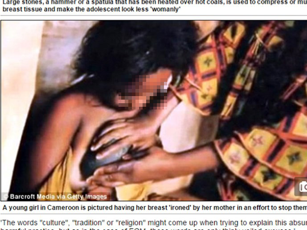 Một bé gái Cameroon bị ủi ngực bằng đá nóng - Ảnh chụp màn hình báo Daily Mail