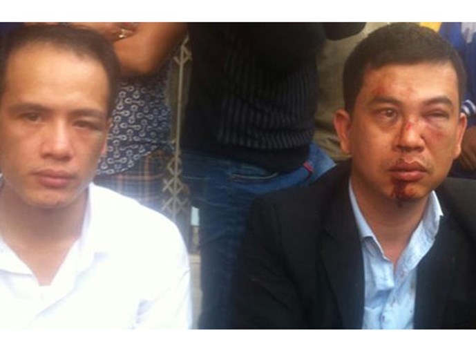 Hình ảnh luật sư Trần Thu Nam bị đánh được đăng tải trên Facebook của LS Lê Văn Luân và Trần Thu Nam