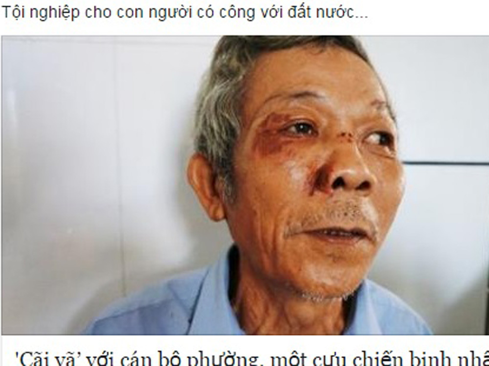 Ông Nguyễn Tấn Mức với nhiều vết thương ở vùng mặt đang điều trị tại Bệnh viện ĐH Y dược Huế