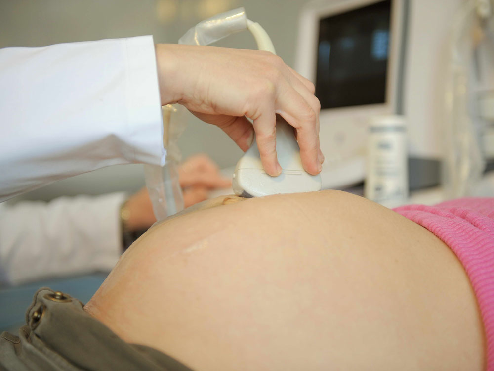 Siêu âm giúp chẩn đoán sức khỏe thai nhi - Ảnh: Shutterstock