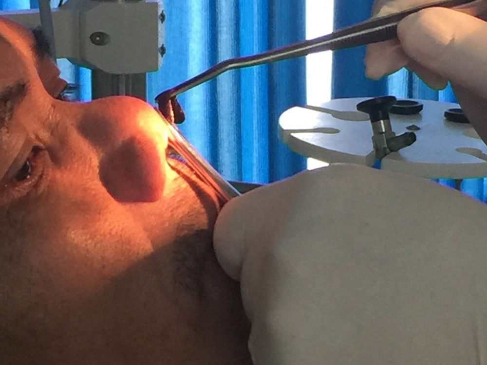 Các bác sĩ gắp con đỉa trong mũi bệnh nhân L. - Ảnh: Bệnh viện đa khoa khu vực Cam Ranh cung cấp