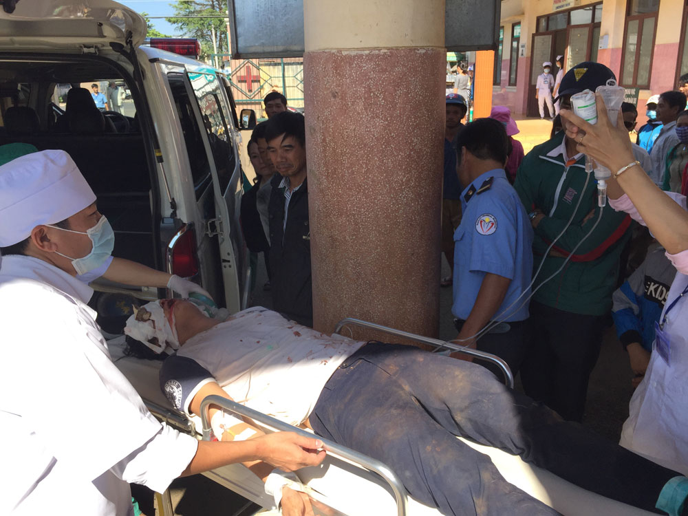 Cành cà phê lớn vẫn còn nguyên trong hốc mắt Thuận khi đến Bệnh viện II Lâm Đồng cấp cứu - Ảnh: Trùng Dương