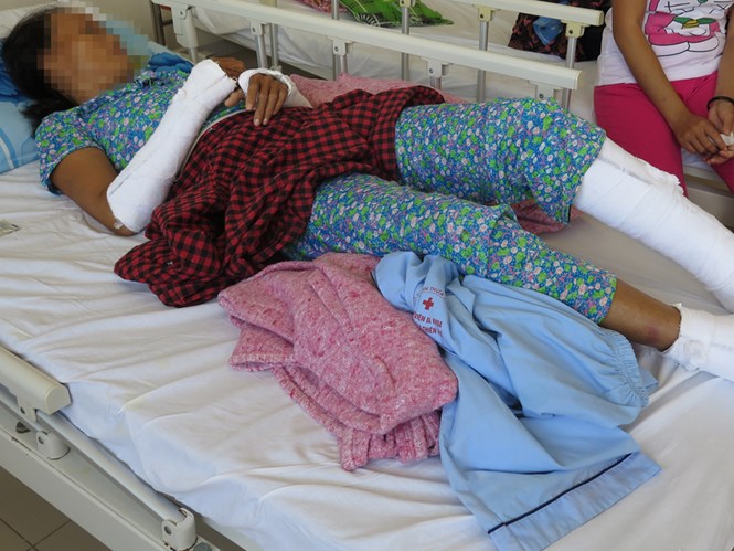 Bà Lê Th.Ph (xã Phong Sơn, huyện Phong Điền, Thừa Thiên - Huế) phải bó bột tứ chi vì bị chồng đánh. Vụ việc xảy ra ngày 2.10.2014 - Ảnh: B.N.L