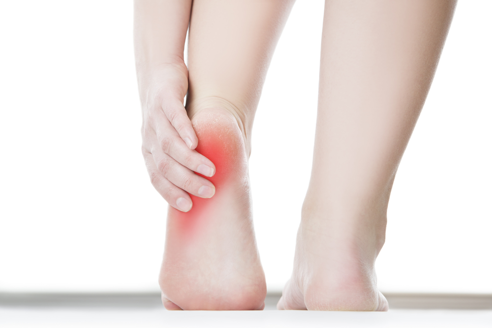 Có nhiều cách chữa đau gót chân tự nhiên - Ảnh: Shutterstock
