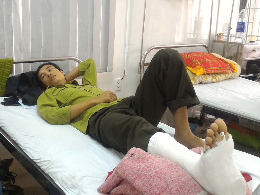 Anh Lê Anh Tuấn đang điều trị tại Bệnh viện Trường đại học Y Dược Huế	- Ảnh: B.N.L