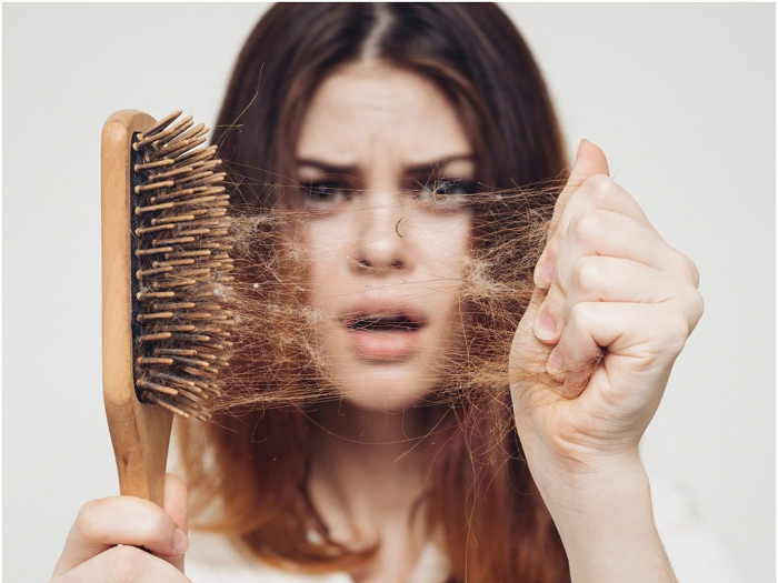 Các nguyên nhân gây rụng tóc ở nam giới | Vinmec