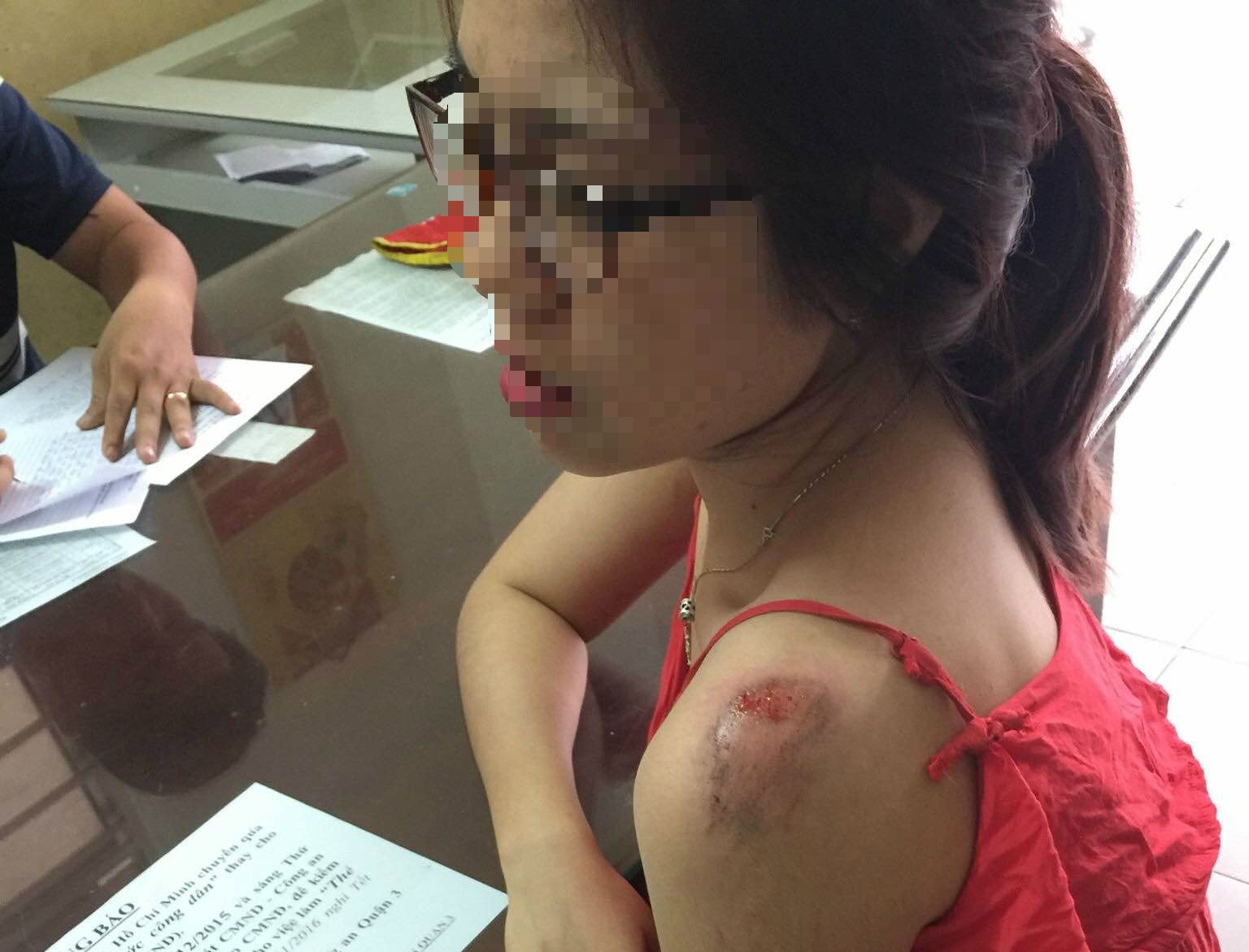 HÌnh ảnh người bị trầy xước được chia sẻ trên mạng xã hội - Ảnh: Facebook Hoa Dai