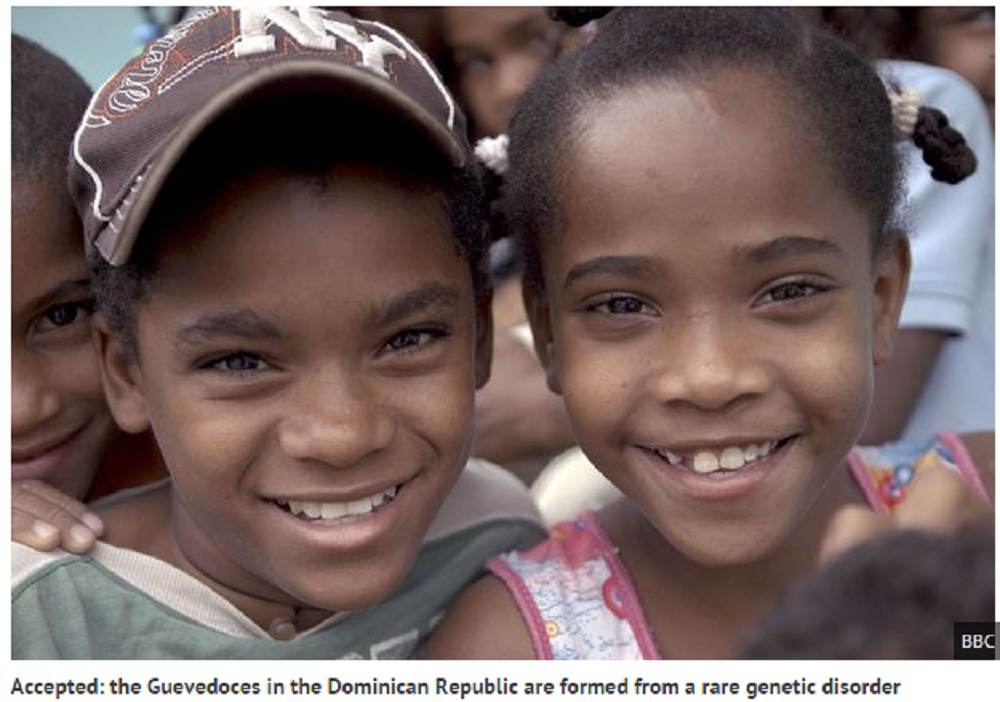 Các bé gái ở làng Salinas, Cộng hoà Dominica biến thành nam khi đến tuổi dậy thì - Ảnh chụp màn hình The Mirror