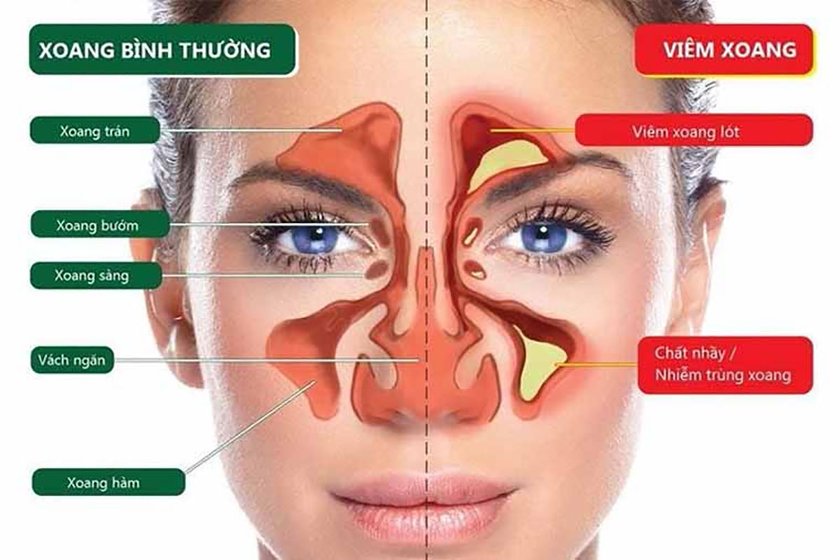 Chuẩn bị trước khi phẫu thuật nâng mũi