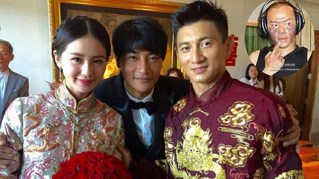 Trần Chí Bằng (giữa) trong đám cưới của Ngô Kỳ Long, Lưu Thi Thi và khuôn mặt bị bỏng nặng lúc trước - Ảnh: Weibo NV