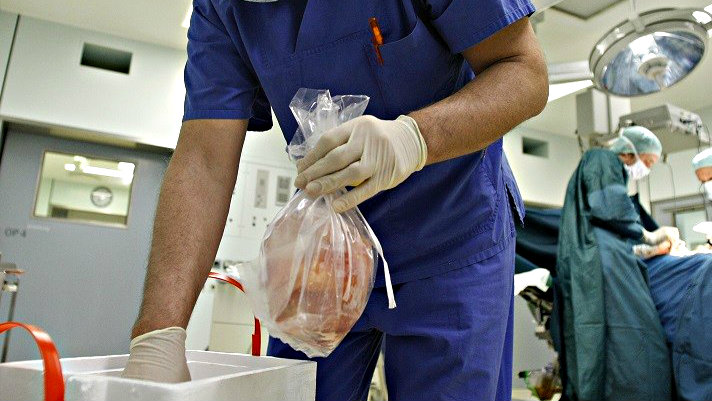 Sử dụng nội tạng cấy ghép cho bệnh nhân - Ảnh minh họa: Reuters