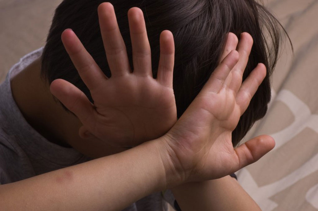 Trẻ bị xâm hại thường co mình lại, bối rối với xung quanh - Ảnh: Shutterstock