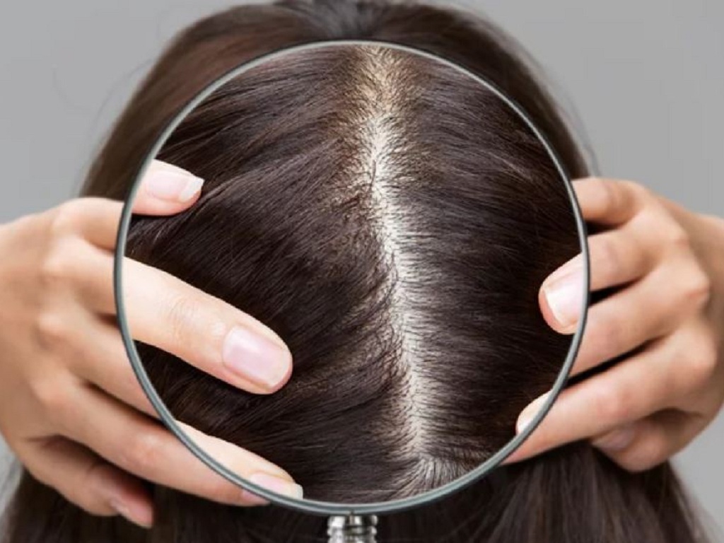6 nguyên nhân gây rụng tóc ở nam giới