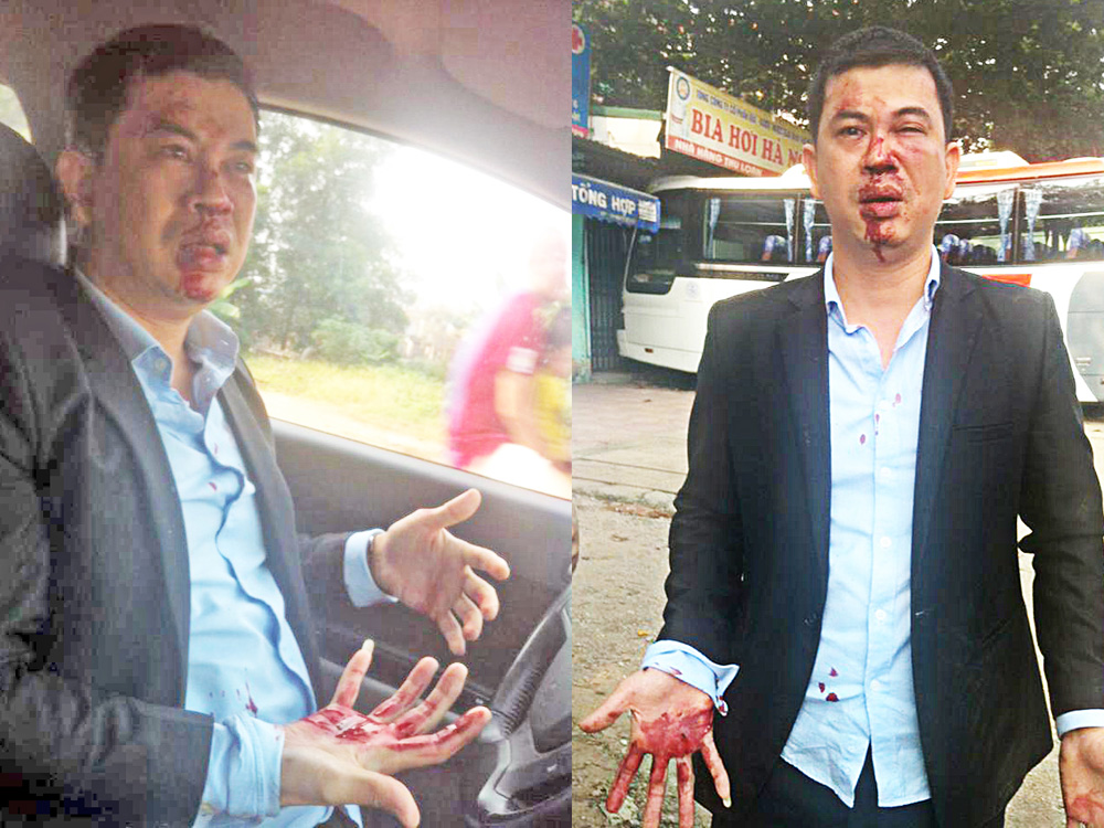 Những hình ảnh về luật sư Trần Thu Nam bị đánh được đăng tải trên Facebook của luật sư này