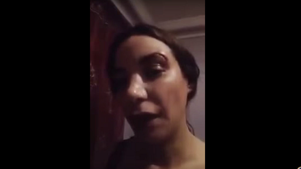 Loubna Abidar chia sẻ câu chuyện của mình với khuôn mặt bầm tím - Ảnh chụp màn hình clip