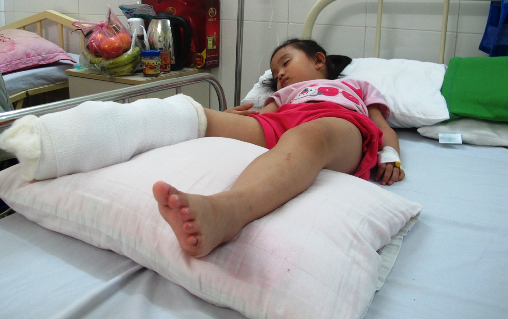 Bé Ngọc Anh 4 tuổi cũng bị chém dã man đứt gân chân - Ảnh: Nguyễn Tú