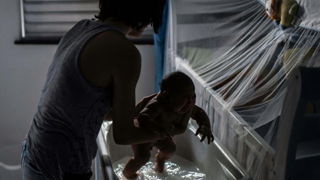 Một nghiên cứu mới cho thấy đôi mắt của những bé sơ sinh cũng nhiều khả năng bị vi rút Zika tấn công - Ảnh: AFP