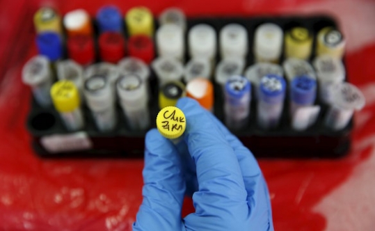 Mẫu máu từ một bệnh nhân bị muỗi đốt tại Viện Sức khỏe quốc gia ở Lima, Peru - Ảnh Reuters