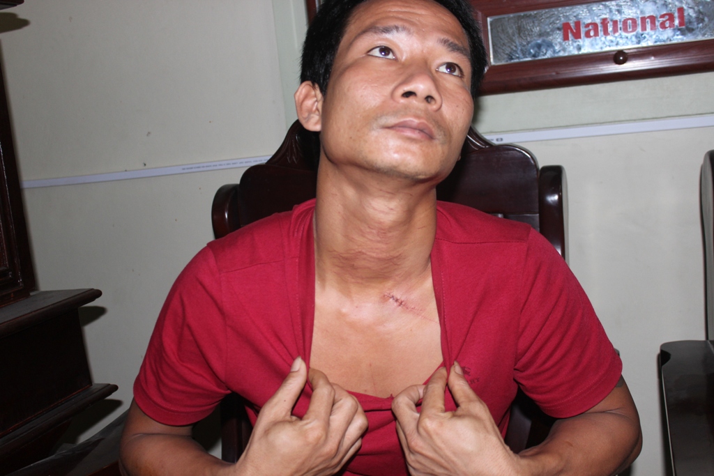 Anh Nguyễn Văn Quảng bị khâu 4 mũi ở cổ, 2 mũi ở tay phải - Ảnh: Phạm Đức