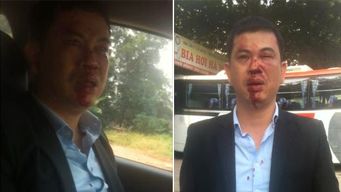 Những hình ảnh về luật sư Trần Thu Nam bị đánh được đăng tải trên Facebook của luật sư này