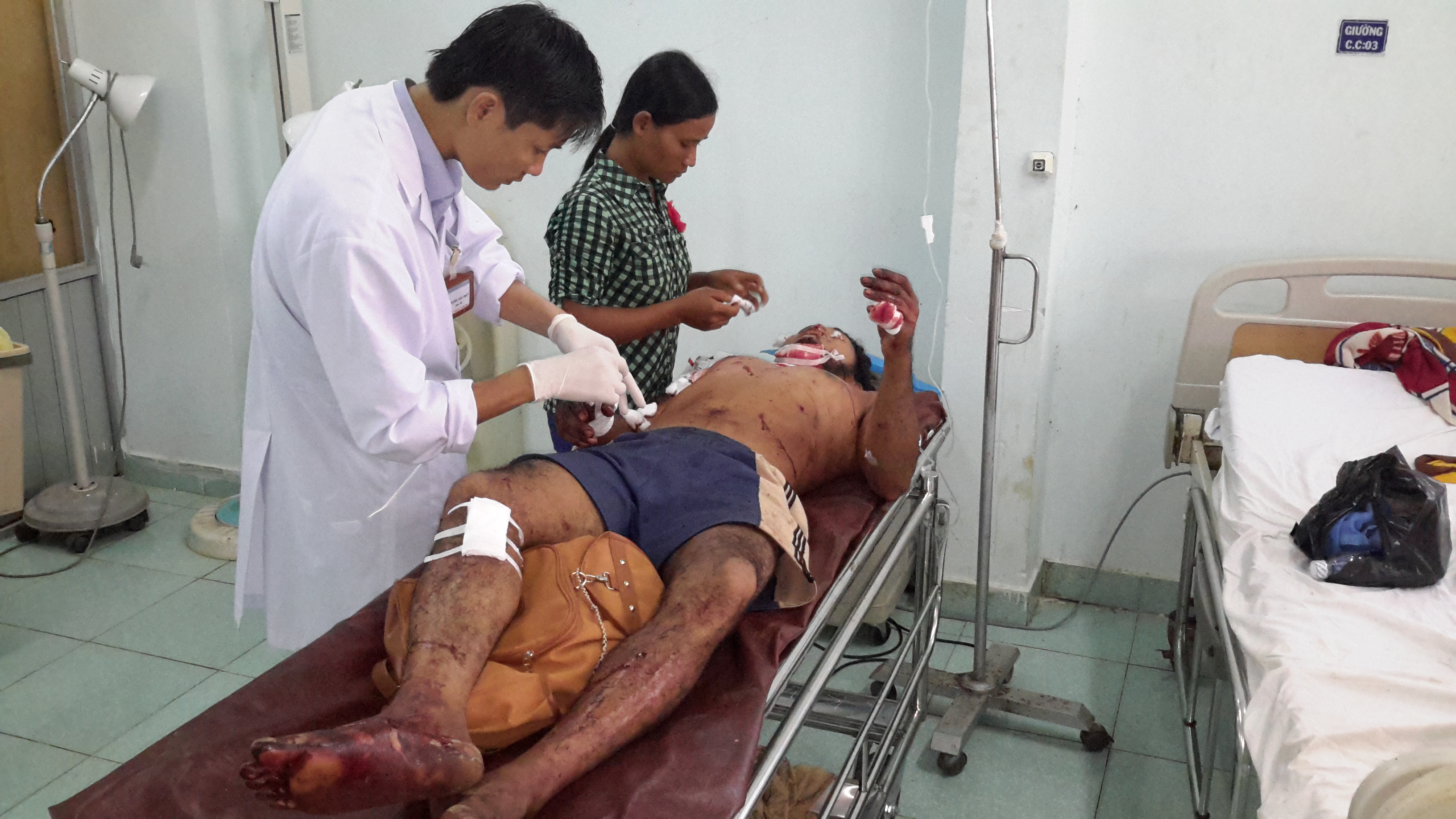 Nạn nhân của một vụ nổ đầu đạn xảy ra ở thị xã Gia Nghĩa, tỉnh Đắk Nông, vào tháng 8.2015 - Ảnh minh họa: Phan Bá