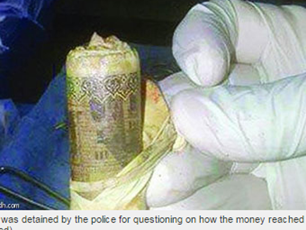 Túi tiền được phát hiện trong dạ dày bệnh nhân - Ảnh chụp màn hình trang tin Emirates 247