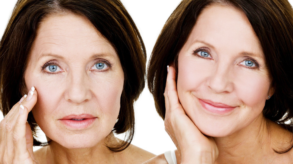 Theo tuổi tác, collagen và elastin bị suy yếu dẫn đến các nếp nhăn và sự chảy xệ